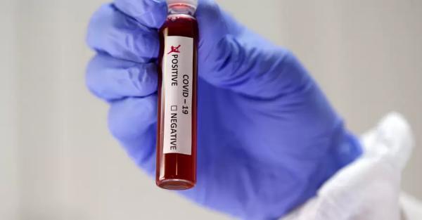 В Чехии обнаружили новый вариант Дельта-штамма коронавируса - Коронавирус
