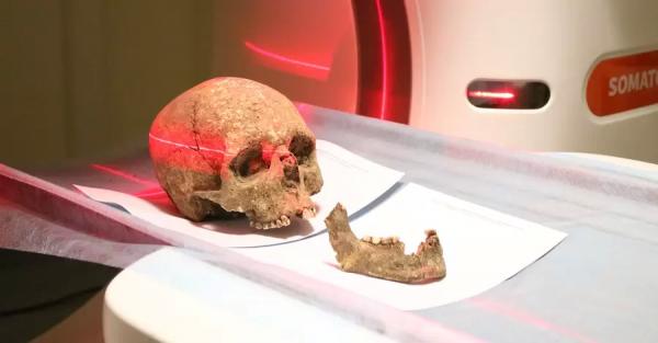 На Тернопольщине отсканировали череп, чтобы выяснить, как выглядел местный житель три тысячи лет назад - 