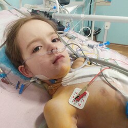 Во Львове сделали сверхсложную операцию ребенку с тяжелыми пороками сердца - Life