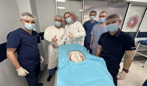 Львовские трансплантологи пересадили печень, задействовав уникальный аппарат - Life